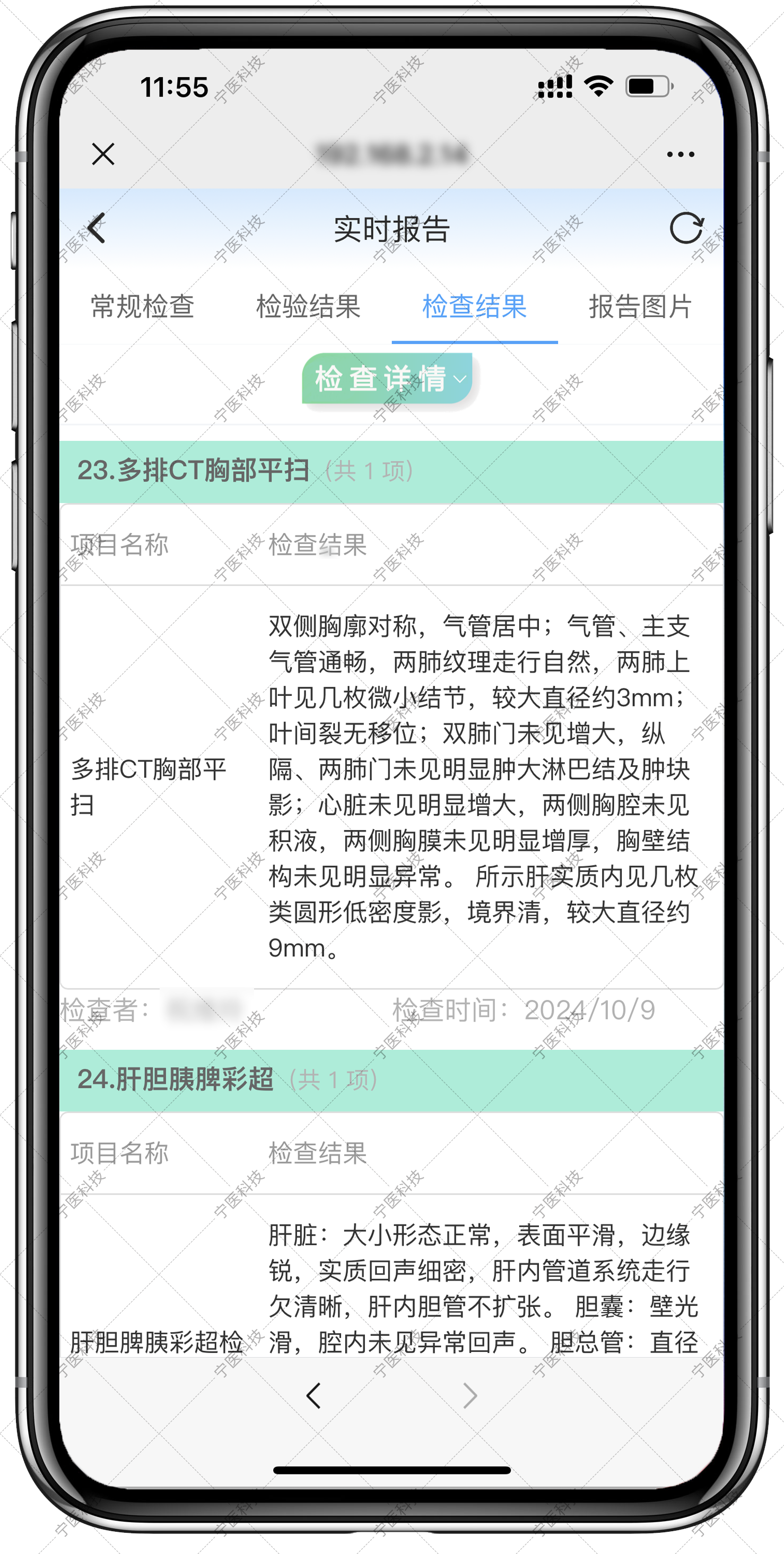实时报告-检查结果.png